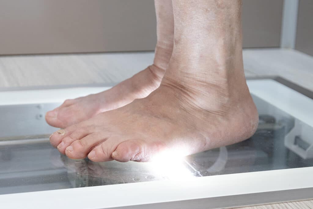 Diabetiker aufgepasst: Ihre Füße brauchen jetzt besondere Aufmerksamkeit!